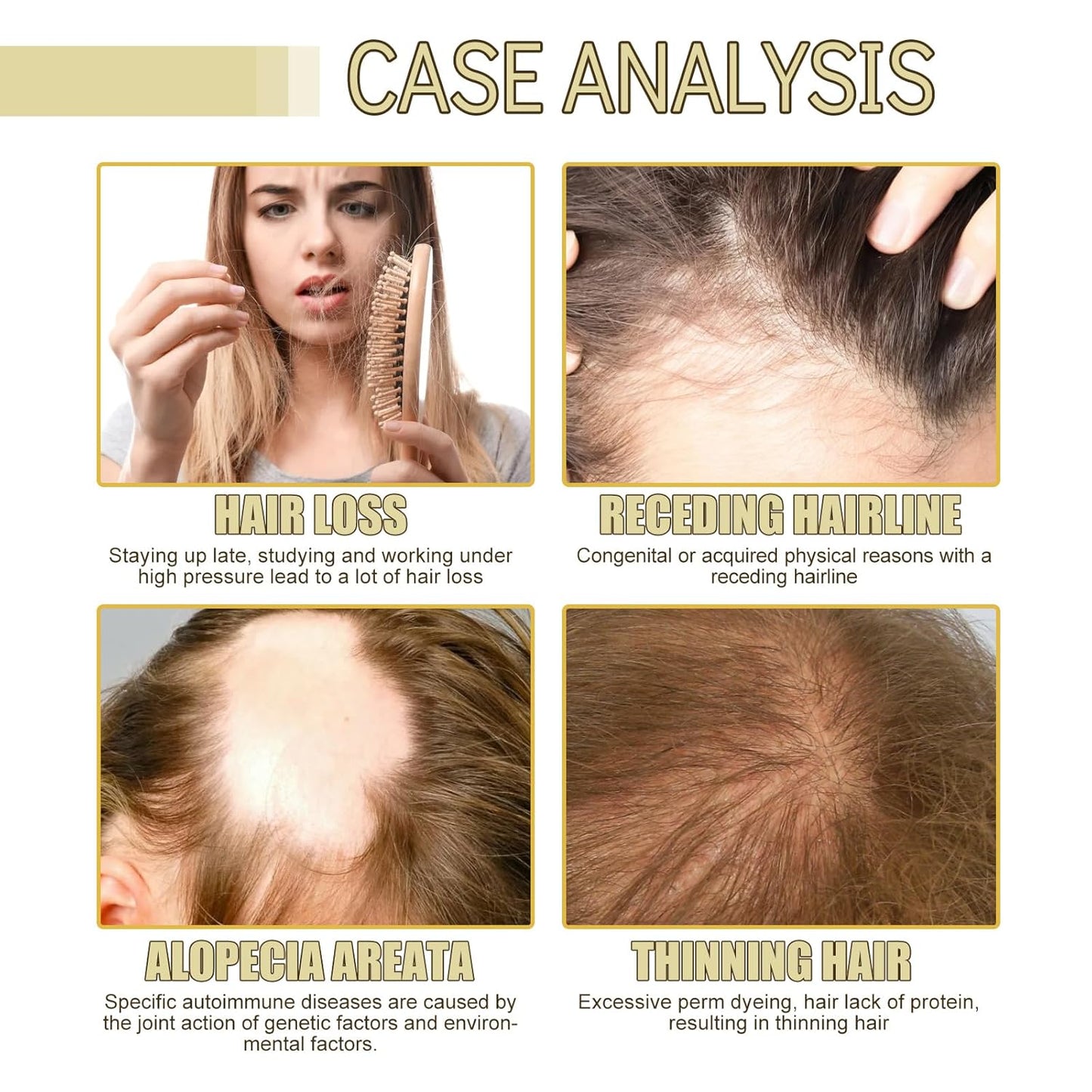 Thrive Locks™ - Hair Growth Oil