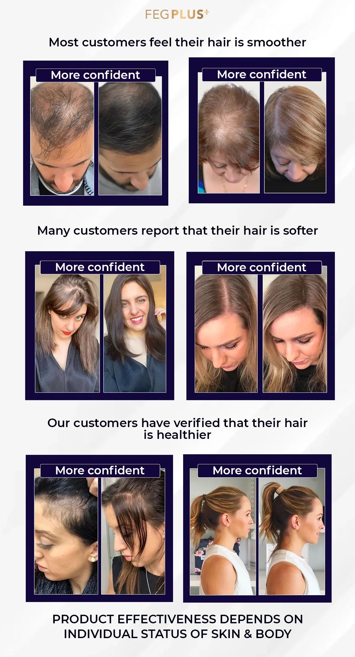 FEG PLUS | Most Viral Hair Growth Spray