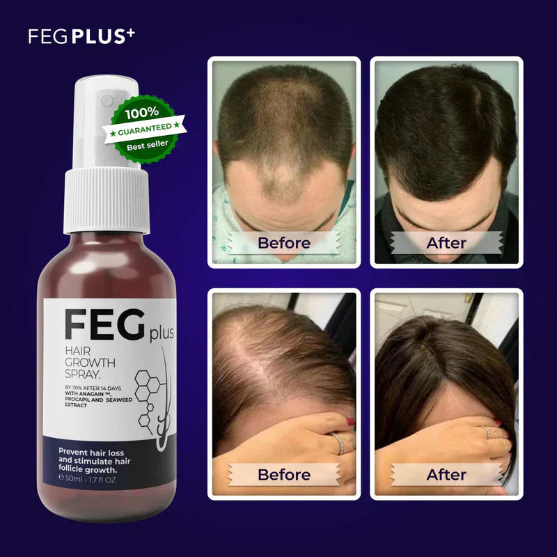 FEG PLUS | Most Viral Hair Growth Spray