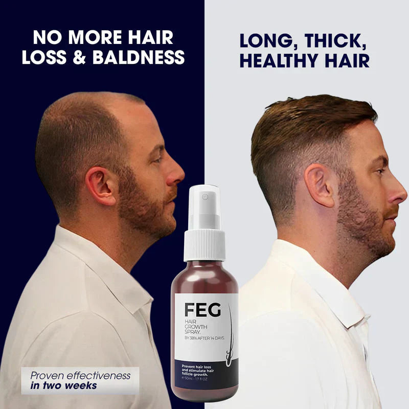 FEG PLUS | Most Viral Hair Growth Spray